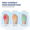 Toe Alignment Corrector – Realign Your Toe