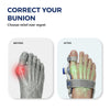Toe Alignment Corrector – Realign Your Toe